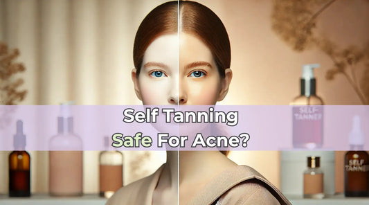 Are Self-Tanners Safe for Acne-prone Skin?