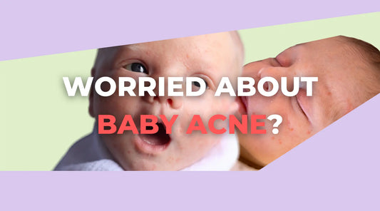 Baby Acne: A Common and Harmless Skin Condition