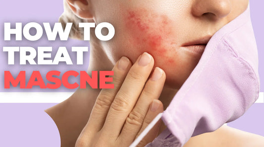 Mascne | How to Treat Acne From Masks