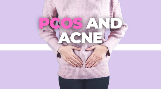 PCOS And Acne