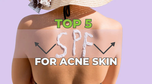 Top 5 Sunscreens for Acne-Prone Skin: Shielding Your Skin Without Clogging Pores